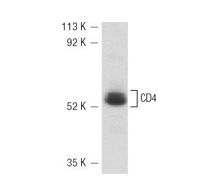 CCRF-CEM Cell Lysate: sc-2225. Western blot analysis of CD4 expression...