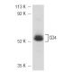 CCRF-CEM Cell Lysate: sc-2225. Western blot analysis of CD4 expression...