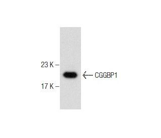 CCRF-CEM nuclear extract: sc-2146. Western blot analysis of CGGBP1 expression... 