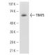 TRAF5 (C-19): sc-6195. Western blot analysis of TRAF5 expression in CCRF-HSB-2 whole cell lysate.