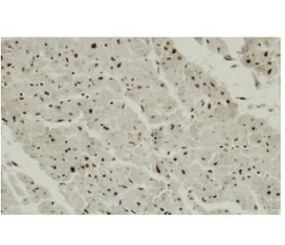 CCRK Antibody (L-35) - Immunohistochemistry - Image 35903