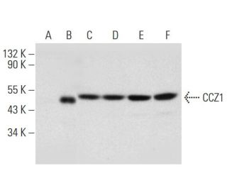 CCZ1 Antibody (B-7) - Western Blotting - Image 318403Each CRISPR/Cas9 Knockout (KO) Plasmid product consists of a pool of 3 plasmids designed to ensure identification and cleavage of a specific gene for maximum knockout efficiency. Each plasmid encodes a unique 20 nt sequence derived from the GeCKO (v2) library.