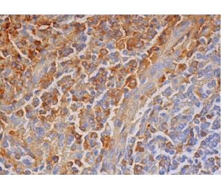 CD10 Antibody (97C5) - Immunohistochemistry - Image 293315 