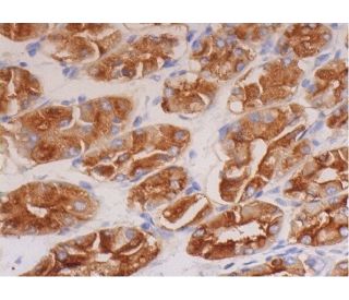 CD15 Antibody (TG-1) - Immunohistochemistry - Image 293299 