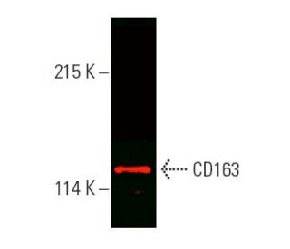 CD163 Antibody (GHI/61) - Western Blotting - Image 388895SAM Transcription Activation: SAM system utilizing dCas9-VP64, MS2-P65-HSF1, and sgRNA for precise gene transcription activation.