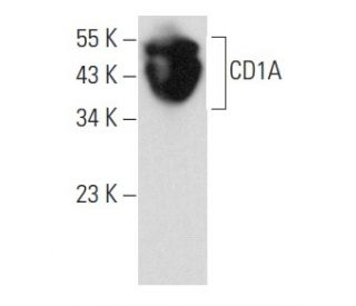 CD1A Antibody (CTB6) - Western Blotting - Image 358044 