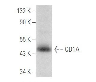 CD1A Antibody (O10) - Western Blotting - Image 355774 
