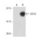 CD1D Antibody (NOR3.2/13.17) - Western Blotting - Image 31291