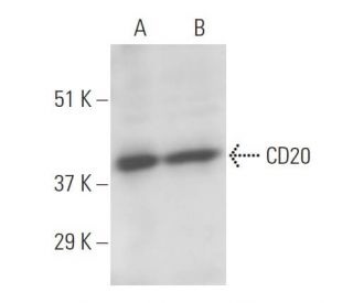 CD20 Antibody (B-LY1) - Western Blotting - Image 11035 