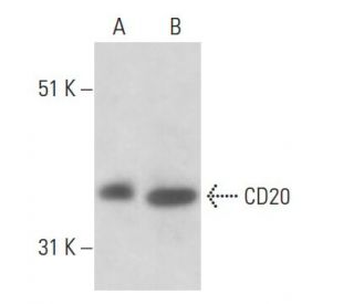 CD20 Antibody (BC-1) - Western Blotting - Image 18040