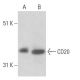 CD20 Antibody (BC-1) - Western Blotting - Image 18040
