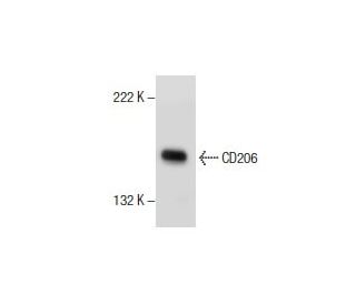 CD206/Mannose Receptor/MMR Antibody (C-10) - Western Blotting - Image 154689 
