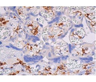 CD206/Mannose Receptor/MMR Antibody (D-1) - Immunohistochemistry - Image 354191 