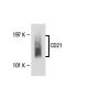 CD21 Antibody (HB-5) - Western Blotting - Image 18079 