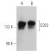 CD22 Antibody (E-9) - Western Blotting - Image 362296