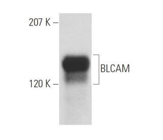 CD22 Antibody (MYG13) - Western Blotting - Image 5637 