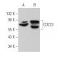 CD223 Antibody (D-8) - Western Blotting - Image 360735 