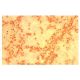 CD23 Antibody (M-L233) - Immunohistochemistry - Image 4774