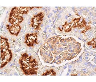 CD26 Antibody (5E8) - Immunohistochemistry - Image 367918 