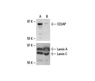 CD2AP siRNA (h): sc-29984. Western blot analysis of CD2AP expression in non-transfected control (A) and CD2AP siRNA transf 