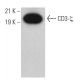 CD3-ζ Antibody (H146-968) - Western Blotting - Image 379374 