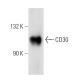 CD30 Antibody (C-3) - Western Blotting - Image 11129