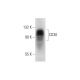 CD30 Antibody (C-3) - Western Blotting - Image 318556 