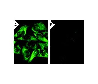 CD30 siRNA (h): sc-29991. Immunofluorescence staining of methanol-fixed, control HeLa (A) and CD30 siRNA silenced HeLa (B) 