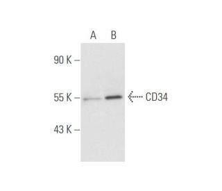 CD34 Antibody (CBR-E8) - Western Blotting - Image 334139