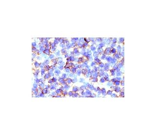 CD35 Antibody (Ber-MAC-DRC) - Immunohistochemistry - Image 4806 
