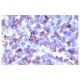 CD35 Antibody (Ber-MAC-DRC) - Immunohistochemistry - Image 4806 