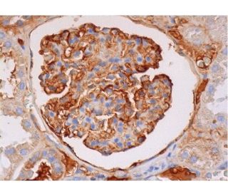 CD35 Antibody (E-11) - Immunohistochemistry - Image 289160 