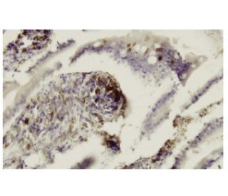 CD39L2 Antibody (SS05) - Immunohistochemistry - Image 35955