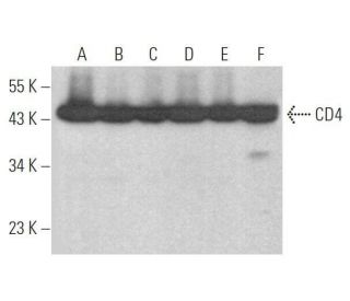 CD4 Antibody (5B4) - Western Blotting - Image 353330 