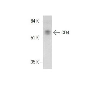 CD4 Antibody (A-1) - Western Blotting - Image 331188 