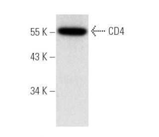 CD4 Antibody (MT310) - Western Blotting - Image 4703 