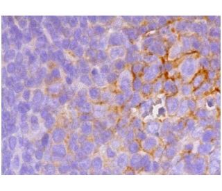 CD4 Antibody (OX38) - Immunohistochemistry - Image 352989 