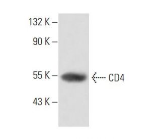 CD4 Antibody (YNB46.1.8) - Western Blotting - Image 16215