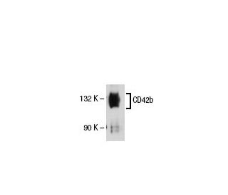 CD42b Antibody (PM6/40) - Western Blotting - Image 21324 