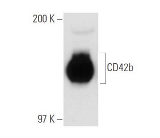 CD42b Antibody (SZ2) - Western Blotting - Image 31140 