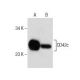CD42c Antibody (F-11) - Western Blotting - Image 281801