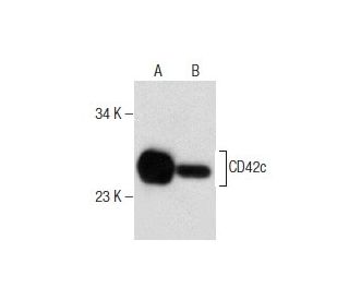 CD42c Antibody (F-11) - Western Blotting - Image 281801SAM Transcription Activation: SAM system utilizing dCas9-VP64, MS2-P65-HSF1, and sgRNA for precise gene transcription activation.