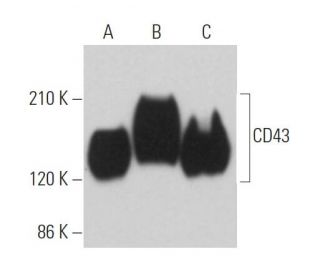 CD43 Antibody (2Q1350) - Western Blotting - Image 363622 
