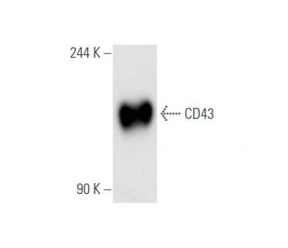 CD43 Antibody (MT1) - Western Blotting - Image 57986 