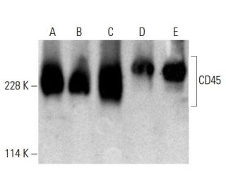 CD45 Antibody (35-Z6) - Western Blotting - Image 384065 