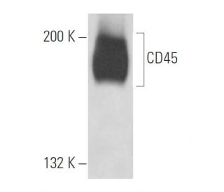 CD45 Antibody (3H1379) - Western Blotting - Image 17610