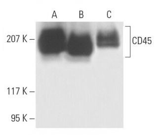 CD45 Antibody (T29/33) - Western Blotting - Image 4846 