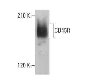CD45R Antibody (6B6) - Western Blotting - Image 376785 