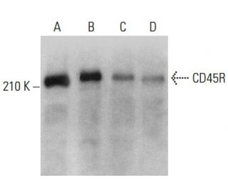 CD45R Antibody (RA3-6B2) - Western Blotting - Image 379486 