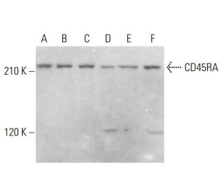 CD45RA Antibody (OX33) - Western Blotting - Image 376784 